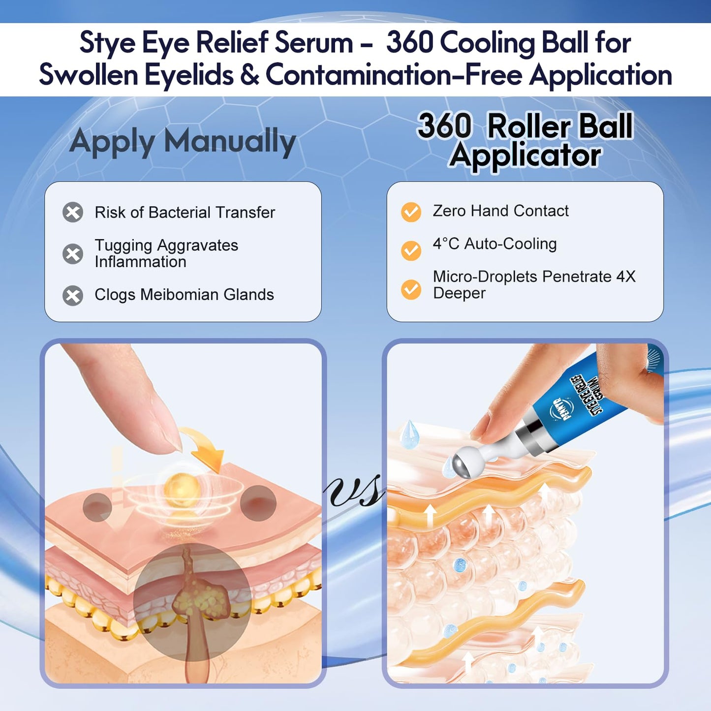 PENNTR Stye Eye Treatment – Plant-Based Roller Serum for Styes, Chalazions & Blepharitis (1 Fl Oz)