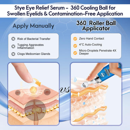 PENNTR Stye Eye Treatment – Plant-Based Roller Serum for Styes, Chalazions & Blepharitis (1 Fl Oz)