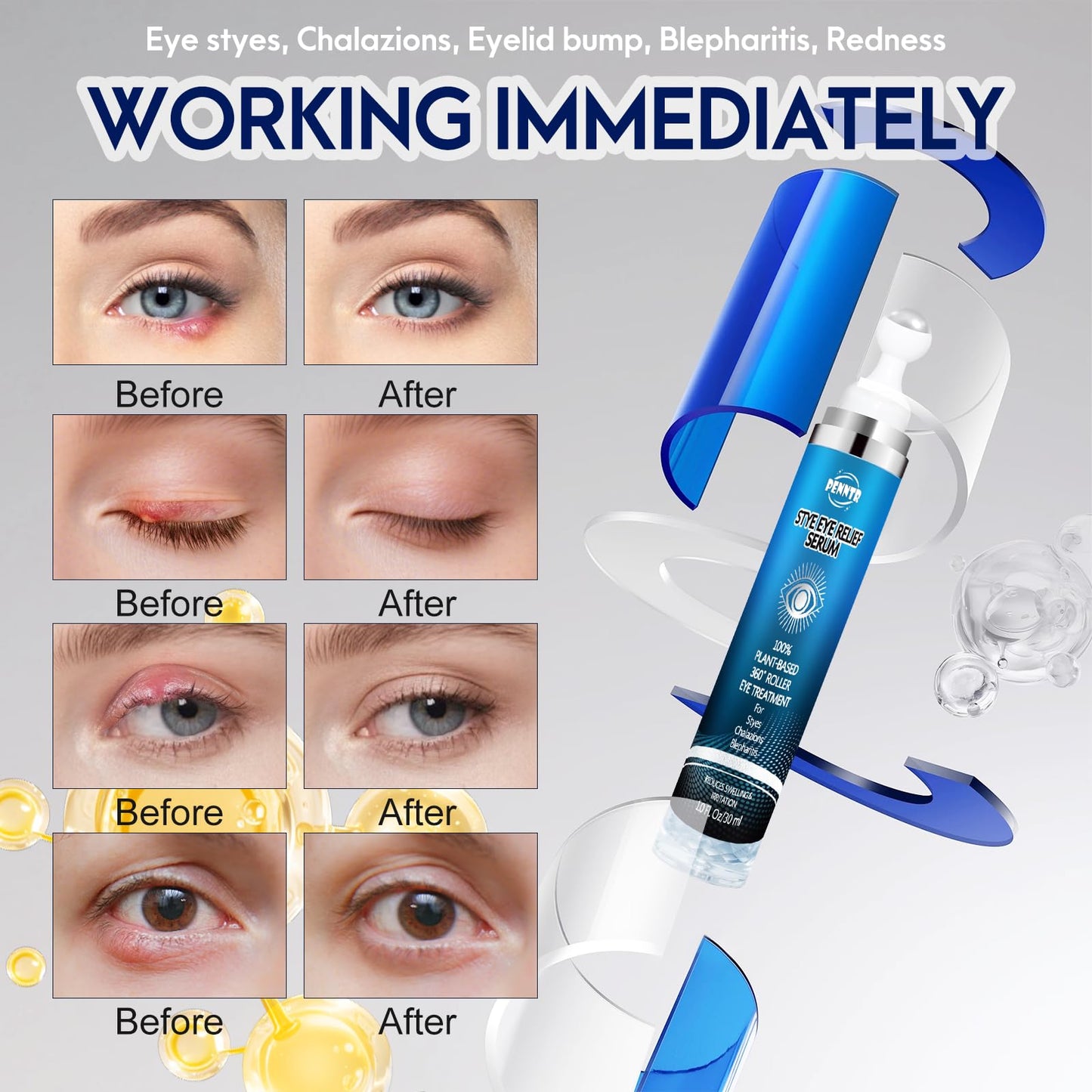 PENNTR Stye Eye Treatment – 360° Rollerball Eye Serum for Eyelid Comfort