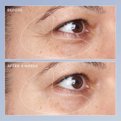 Perricone MD High Potency Triple Retinol Renewal Eye Serum – 0.5 fl oz