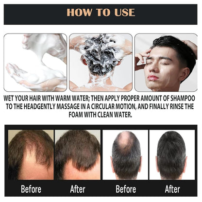 PEWATUL SPARSTAN Root Activator Shampoo – Anti Hair Loss, Natural Regrowth Formula, Thickening & Nourishing | 1pc