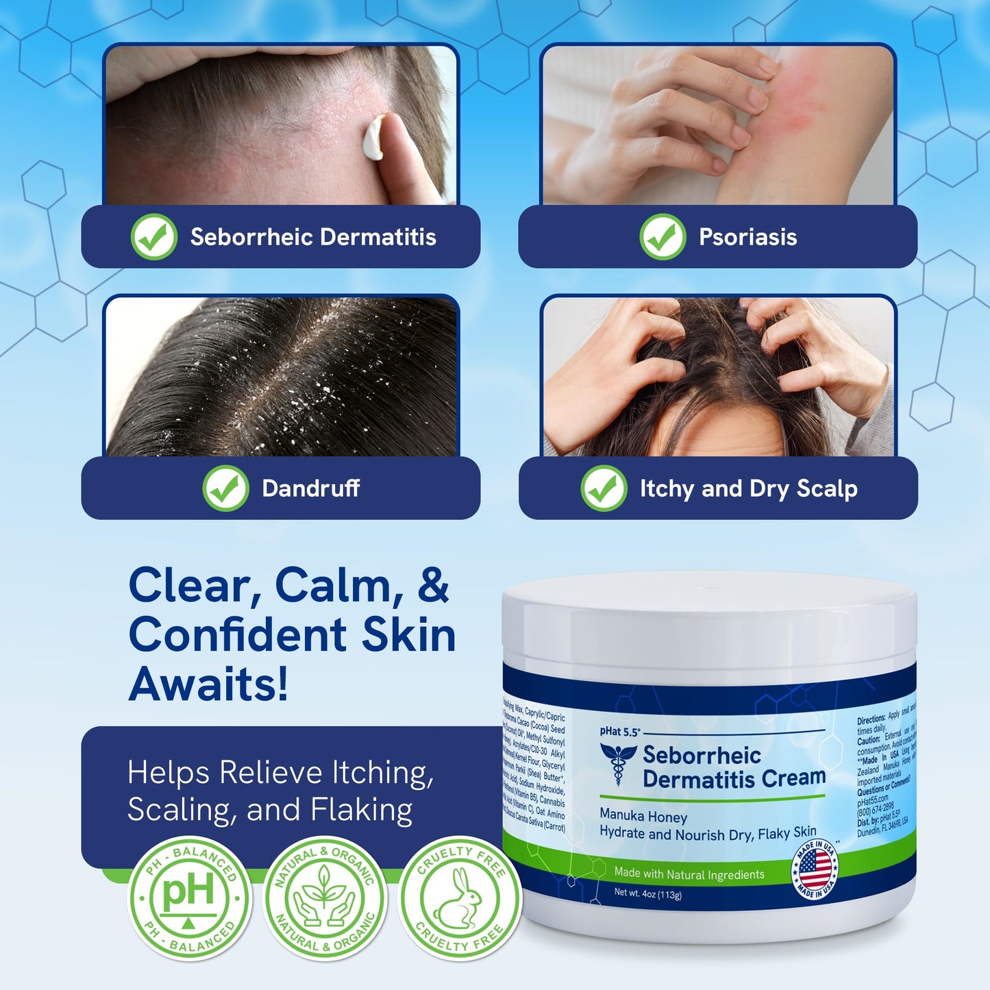 pHat 5.5 Itch Cream – Anti-Itch Relief & Hydration (4oz)