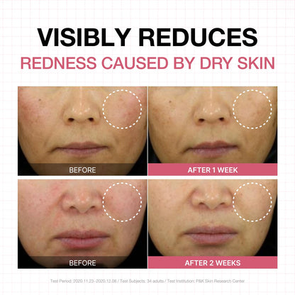 PHYSIOGEL Calming Relief Lotion Reduces Redness in 3 Days for Sensitive Skin