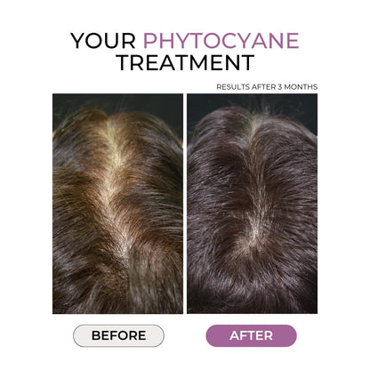 PHYTOCYANE Anti-Hair Thinning Dietary Supplement — 84 Capsules, 12-Week Supply, Vegan & Gluten/Lactose-Free