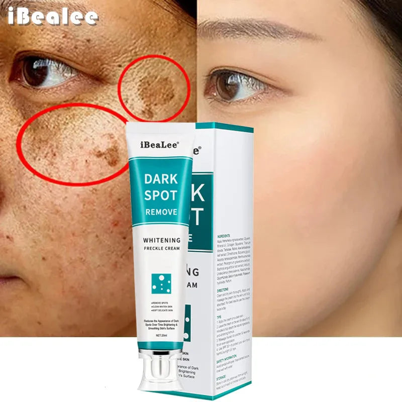 iBeaLee Whitening Anti-Freckle Cream Fading Spot Mild Freckles Removal Age Spot Melasma Repair Cream