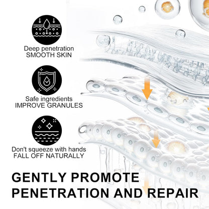 Platicat Milia Remover Serum – Clear Skin Spot Treatment (30ml, 1 Count, Black)