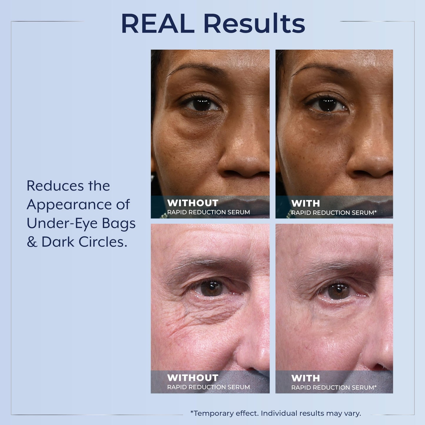Plexaderm Rapid Reduction Eye Serum — Instant Under-Eye Tightening & Smoothing (3 Full-Size Tubes)