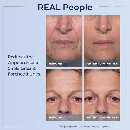Plexaderm Rapid Reduction Eye Serum – Instant Under-Eye Smoothing & Fine Line Relief