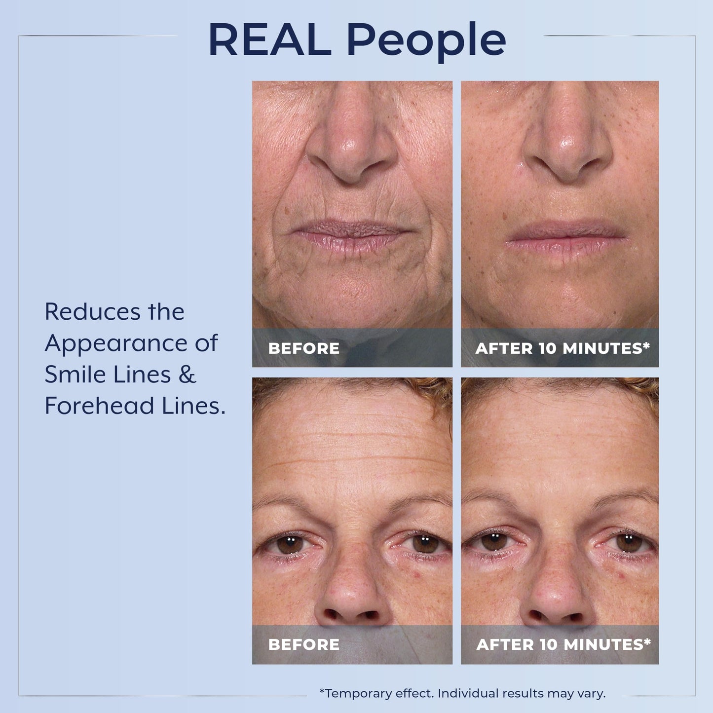 Plexaderm Rapid Reduction Eye Serum – Instant Under-Eye Lift, Reducing Bags & Wrinkles