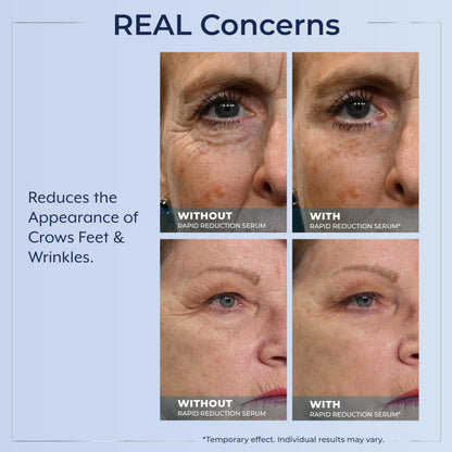 Plexaderm Rapid Reduction Eye Serum – Instant Under-Eye Smoothing & Fine Line Relief