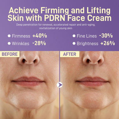 +1HEROLABS PDRN Anti-Aging Face Moisturizer Cream – 5% Squalane, 100% Pure Salmon PDRN, Hyaluronic Acid & B5