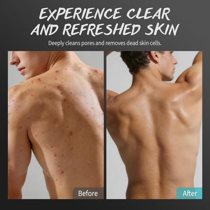 POP MODERN.C Men Body Scrub with Tea Tree Oil – Exfoliating Wash & Scrub (2% BHA, 10% AHA)