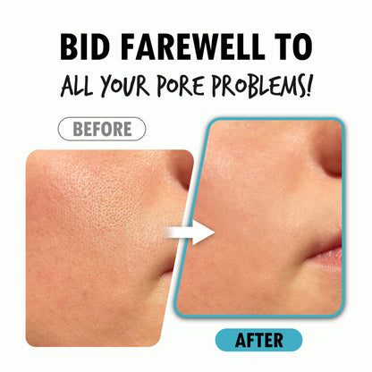 Pour La Peau Pore Refining Serum | Pore Minimizing Hydrating Face Serum (1.01 oz)