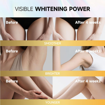 PRFTMK Skin Bleaching Cream with Vitamin C – Dark Spot Remover for Underarms, Elbows, Knees & Bikini Line (50ml)