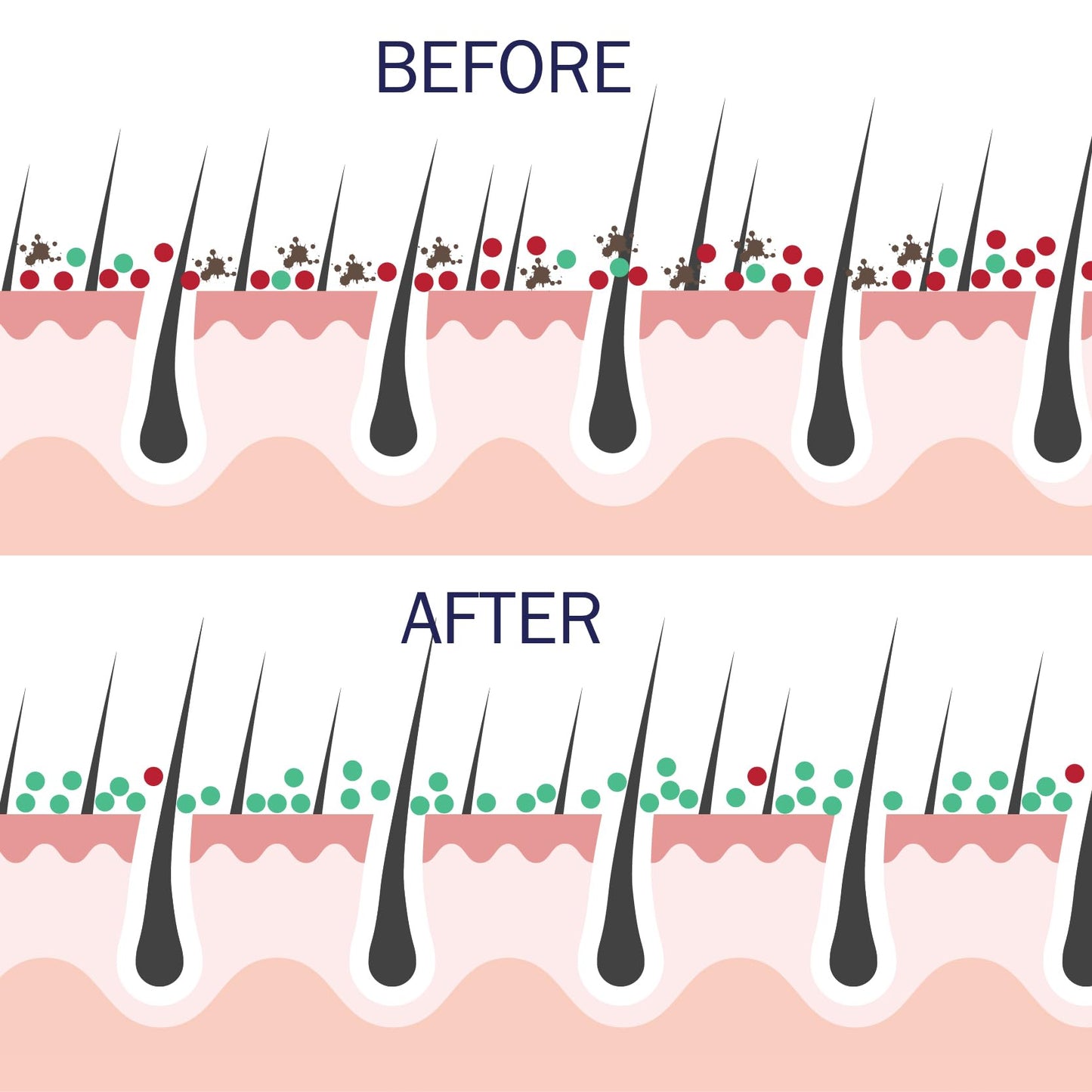 Probiotic Action Clarity in Balance: Science-Backed Bacteria for Acne, Rosacea & Eczema Risk