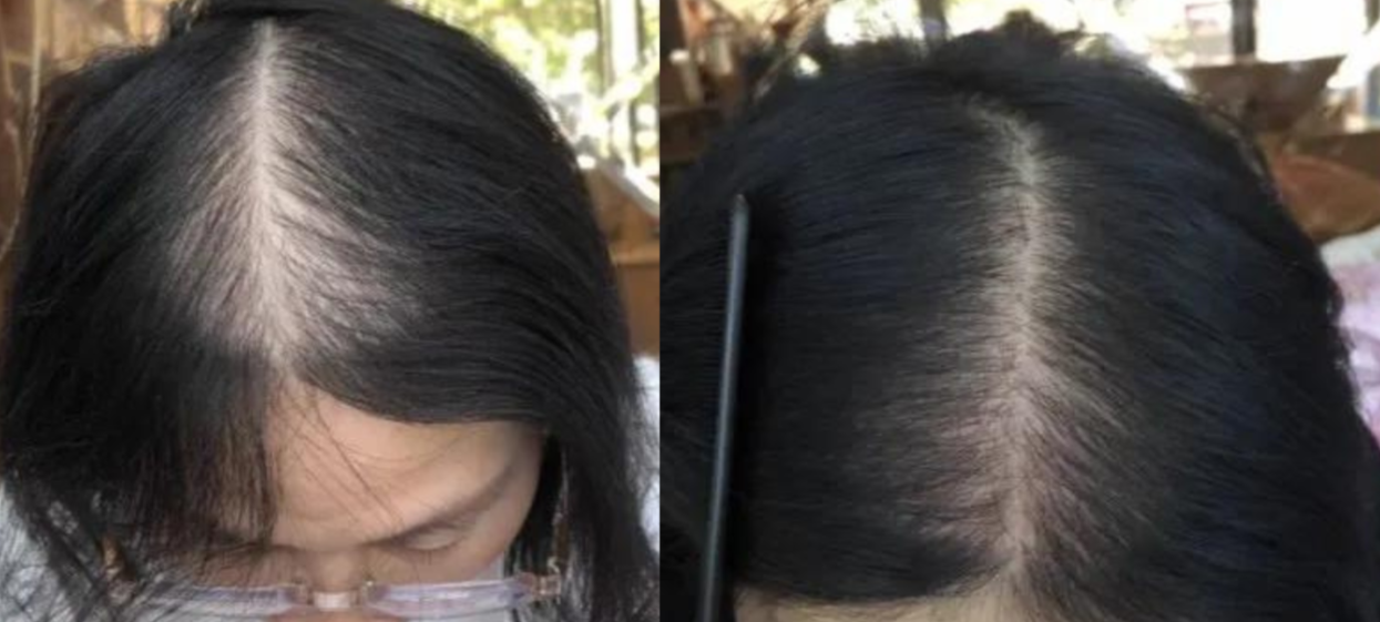 Lustrao Hair regrowth oil