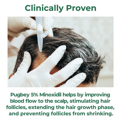 Pugbey 5% Minoxidil Spray for Hair Growth – Men & Women, Beard & Scalp, 3.38 oz (2 Month Supply)