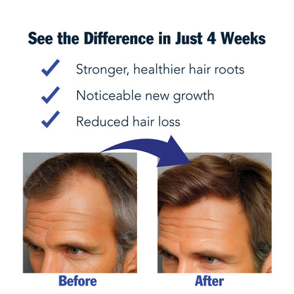 Rosemary Hair Growth Serum Roll-On 2-Pack – 3% Rosemary, 3% Redensyl, DHT-Blocking for Thicker, Fuller Hair | Puggaree