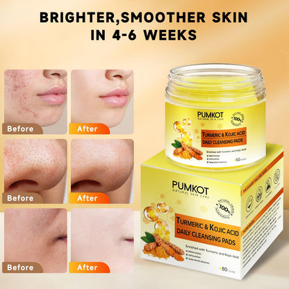 Pumkot Turmeric Kojic Acid Cleansing Pads – 80pcs Gentle Exfoliating Facial Pads