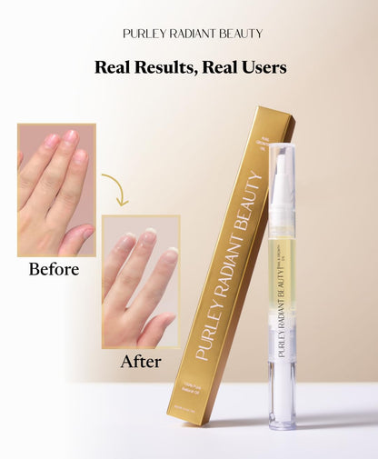 Purely Radiant Beauty Nail Growth Oil – Natural Cuticle Serum for Stronger Nails (3ml) | Jojoba, Castor, Coconut & Argan Oils | USA Made