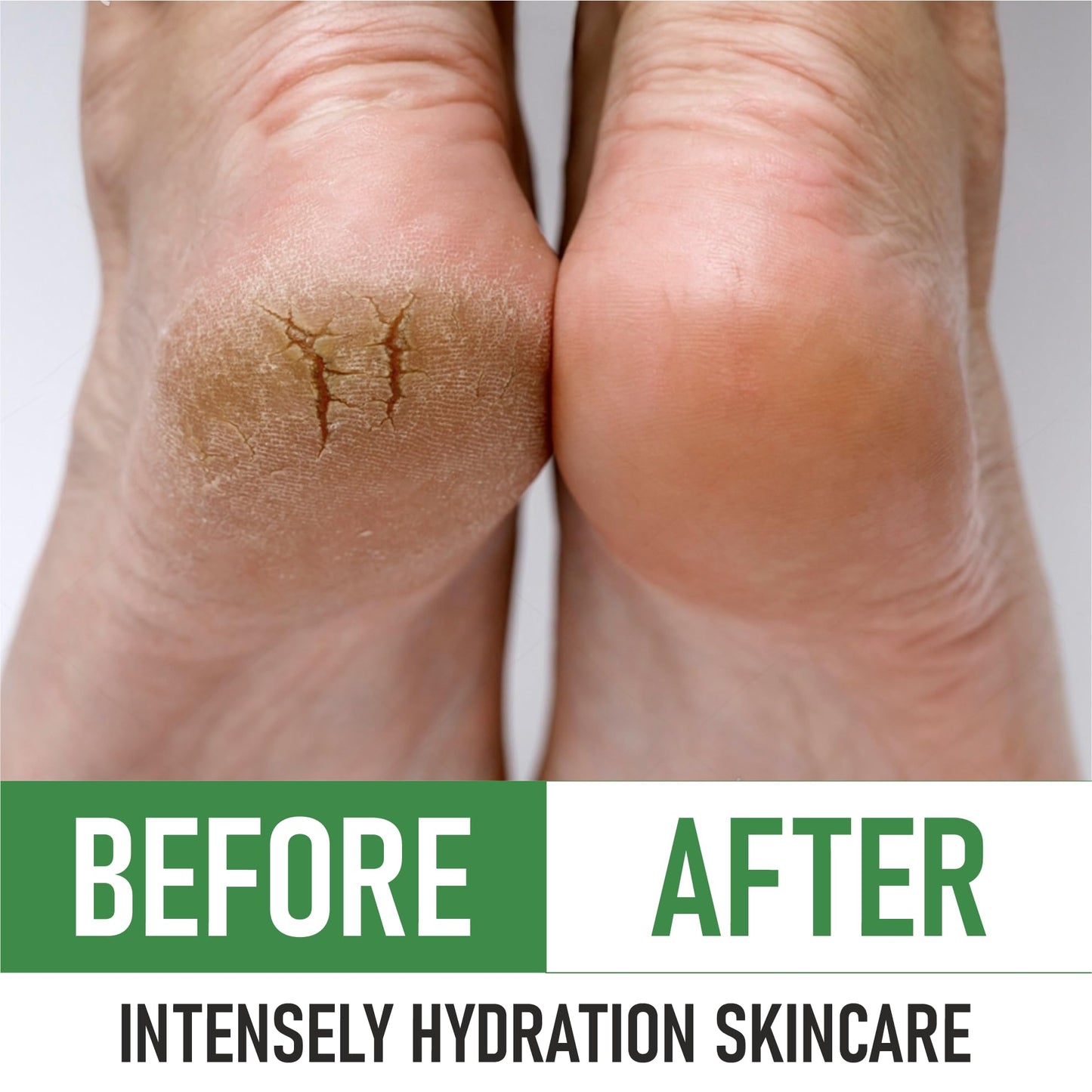 PurOrganica Urea 40% Foot Cream – Intensive Repair for Dry, Cracked Feet (Made in USA)