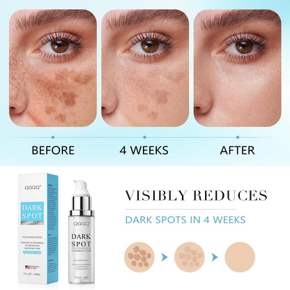 QGGQ Dark Spot Remover Serum – Niacinamide & Alpha-Arbutin for Face & Body
