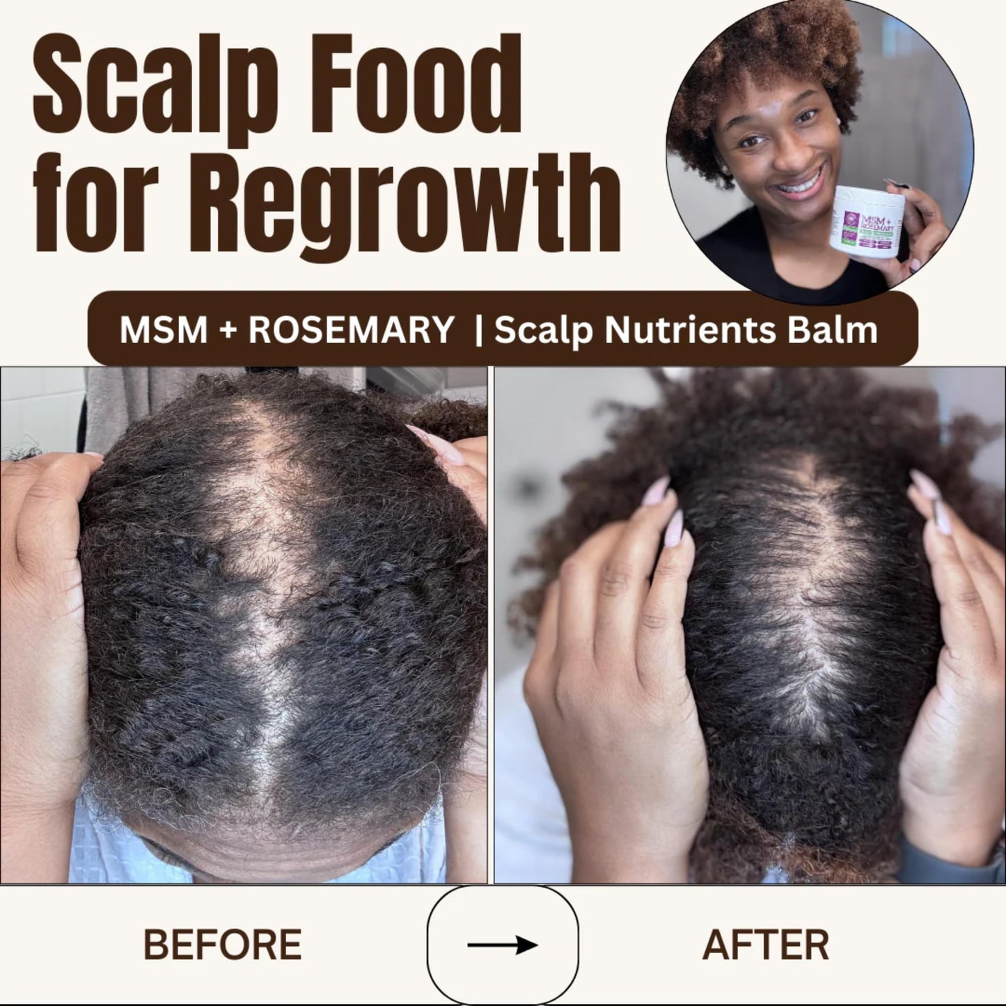 Qhemet Biologics MSM + Rosemary Scalp Nutrients Balm | Scalp Food for Healthy Hair | Vegan (4 oz)