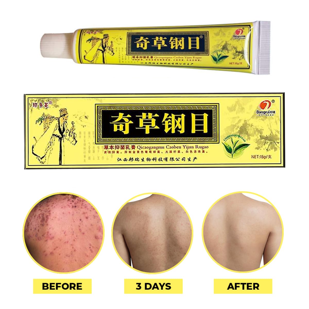 QICAOGANGMU Chinese Herbal Cream – Natural Skin Support, Pack of 3 | Official Seller