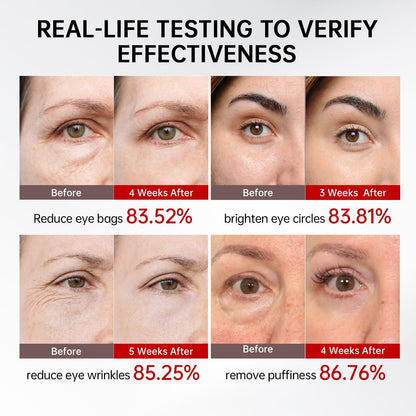 QQE Retinol & Caffeine Eye Serum with 360° Roller – Puffiness, Dark Circles & Wrinkle Support