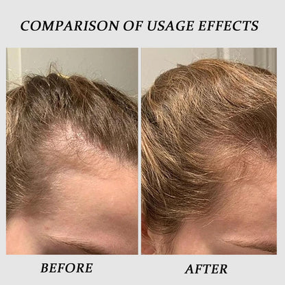 QUZOYU Thicair Hair Regrowth System – Volumizing Serum with Copper Peptides & Collagen