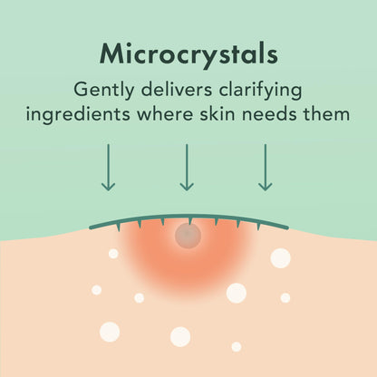 Rael Pimple Patches - Miracle Microcrystal Spot Cover with Tea Tree Oil (27 Count)