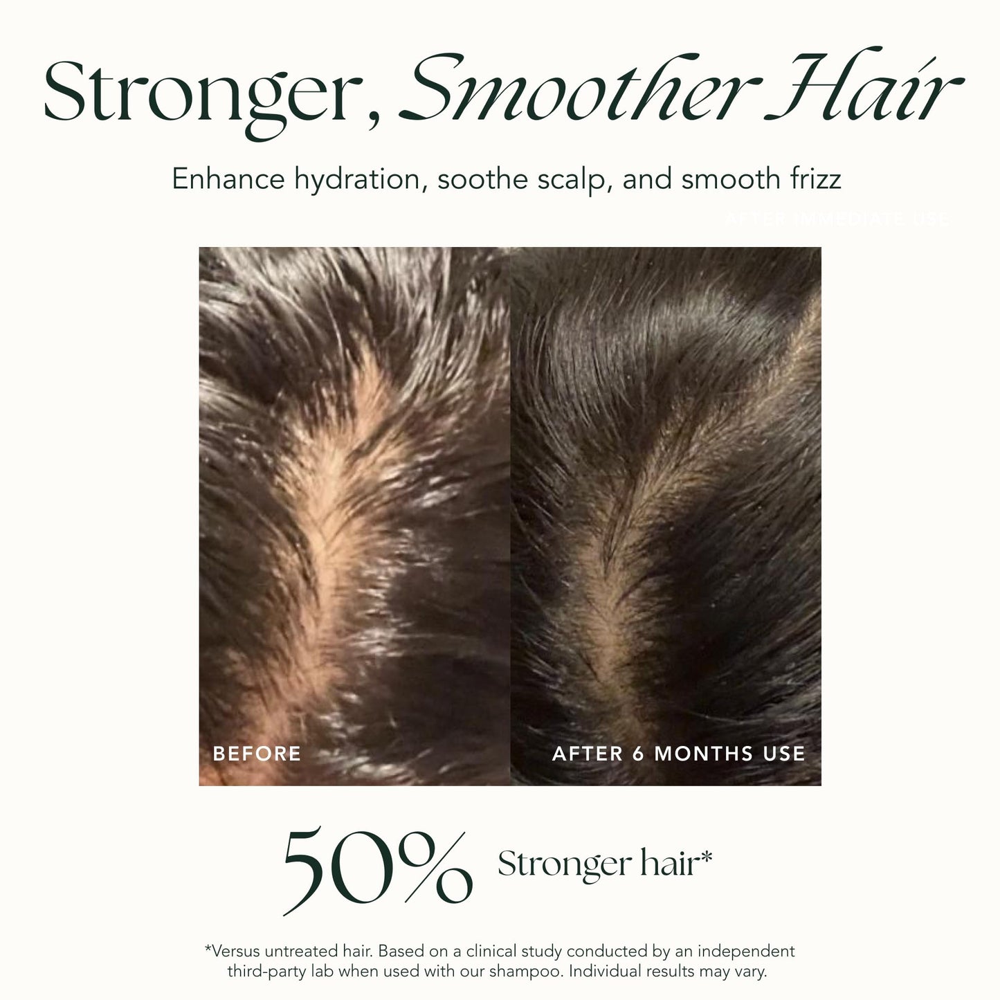 RANAVAT BOTANICS Mighty Majesty Fortifying Hair Serum — Scalp Hydration & Frizz Control