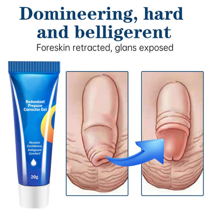 Redundant Prepuce Corrector Gel – Gentle, Non-Invasive Foreskin Care (2pcs)