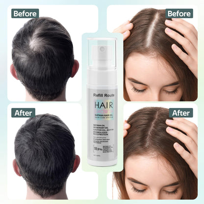 Refill Route Batana Oil Hair Growth Spray – Natural Vegan Hair Regrowth with Rice Water, Biotin & Rosemary