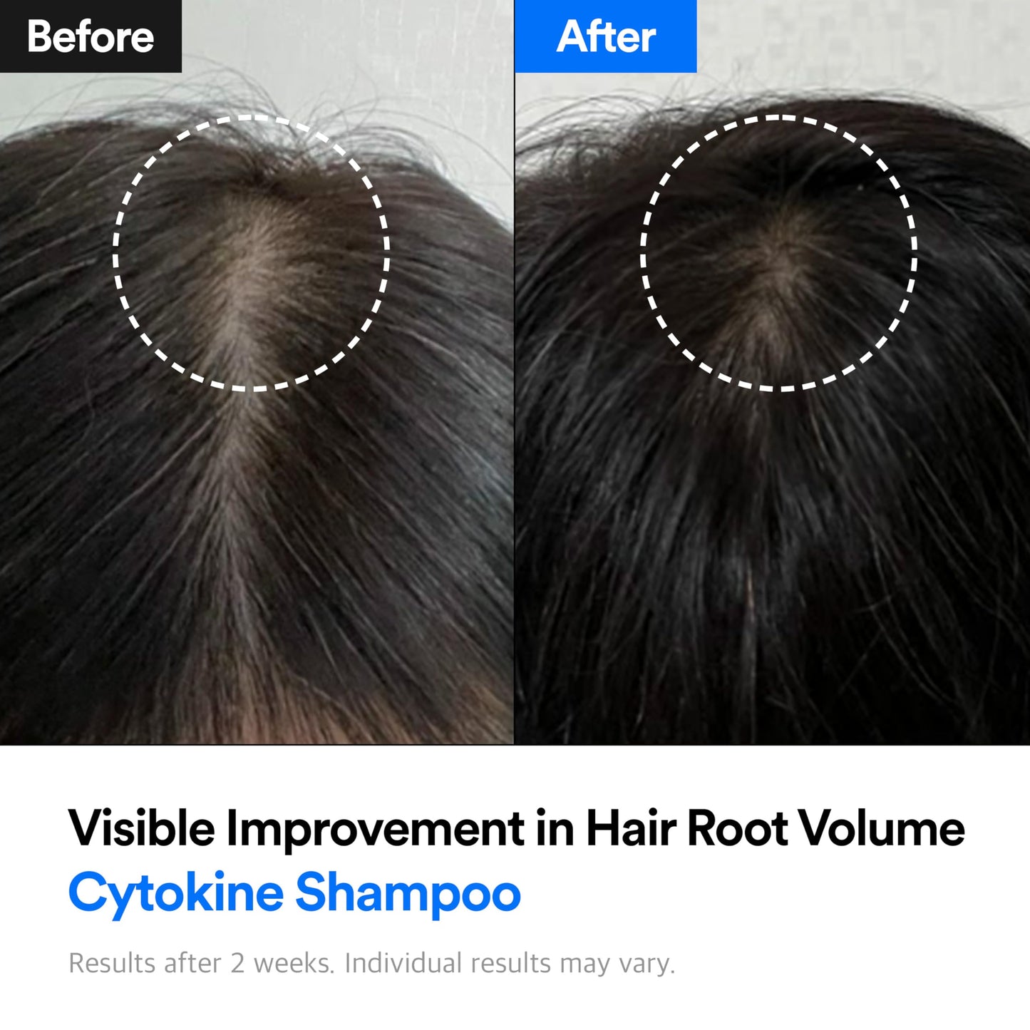 Refilled Hair-Recovery Cytokine Shampoo Plus Sensitive Care – Gentle, Hypoallergenic, Sulfate-Free