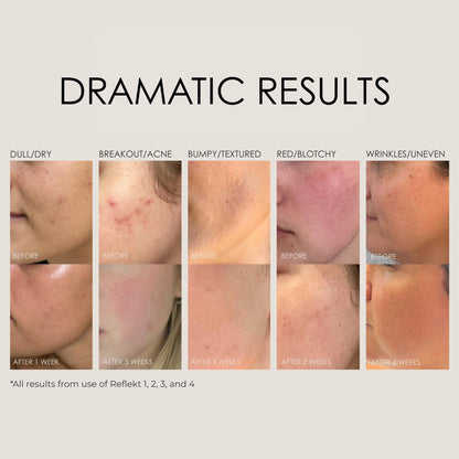 REFLEKT 3 Power Peptide Sculpting Face Cream – PGA, Hyaluronic Acid & Squalane | Clean Vegan