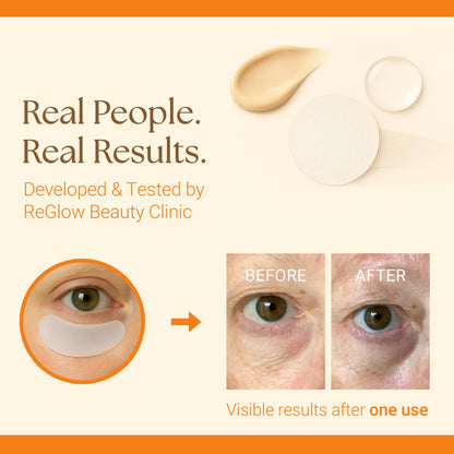 ReGlow Restore Microneedle Eye Patches – Overnight Smoothing with Hyaluronic Acid, Collagen & Peptides