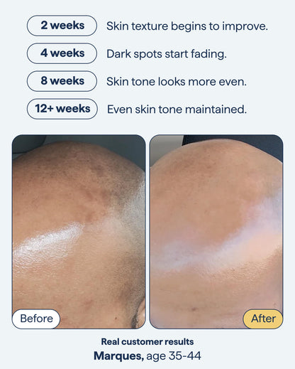 Remedy Science – Remedy for Dark Spots, Advanced Night Treatment with Retinol & Kojic Acid