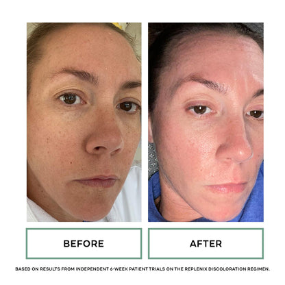 Replenix Brightening Eye Cream | Medical-Grade Hydration for Dark Circles & Puffiness