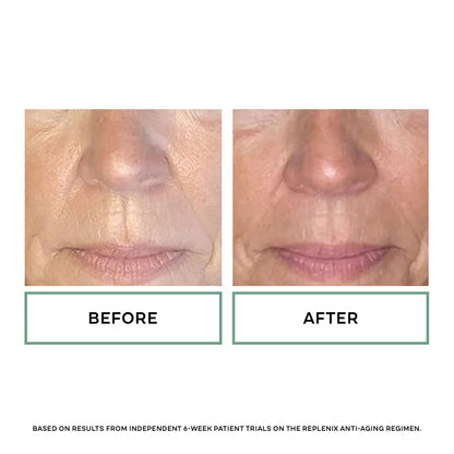 Replenix Retinol 5X Regenerate Dry Serum – Fast-Absorbing Anti-Aging for Mature Skin