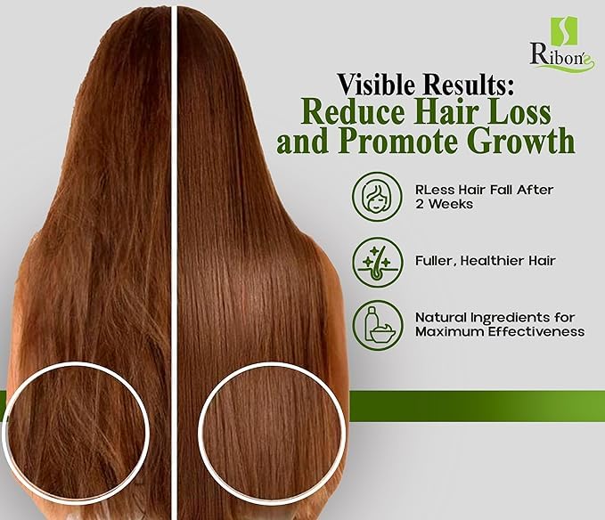 Ribon's Natural Shampoo & Hair Treatment Set – Onion, Rosemary & Aloe for Hair Growth (450ml x 2)