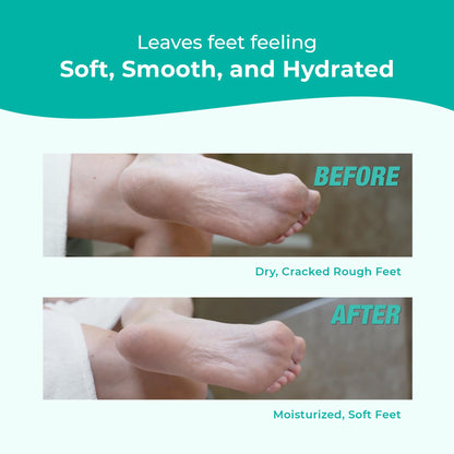 Richenna EZ Foot Care Cream – Advanced Exfoliating Urea Foot Cream for Dry Cracked Heels | 14 Natural Ingredients | 100ml