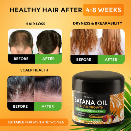 RICHGRAND Batana Oil – 100% Raw Unrefined Batana Butter for Hair & Skin (5.3 oz)