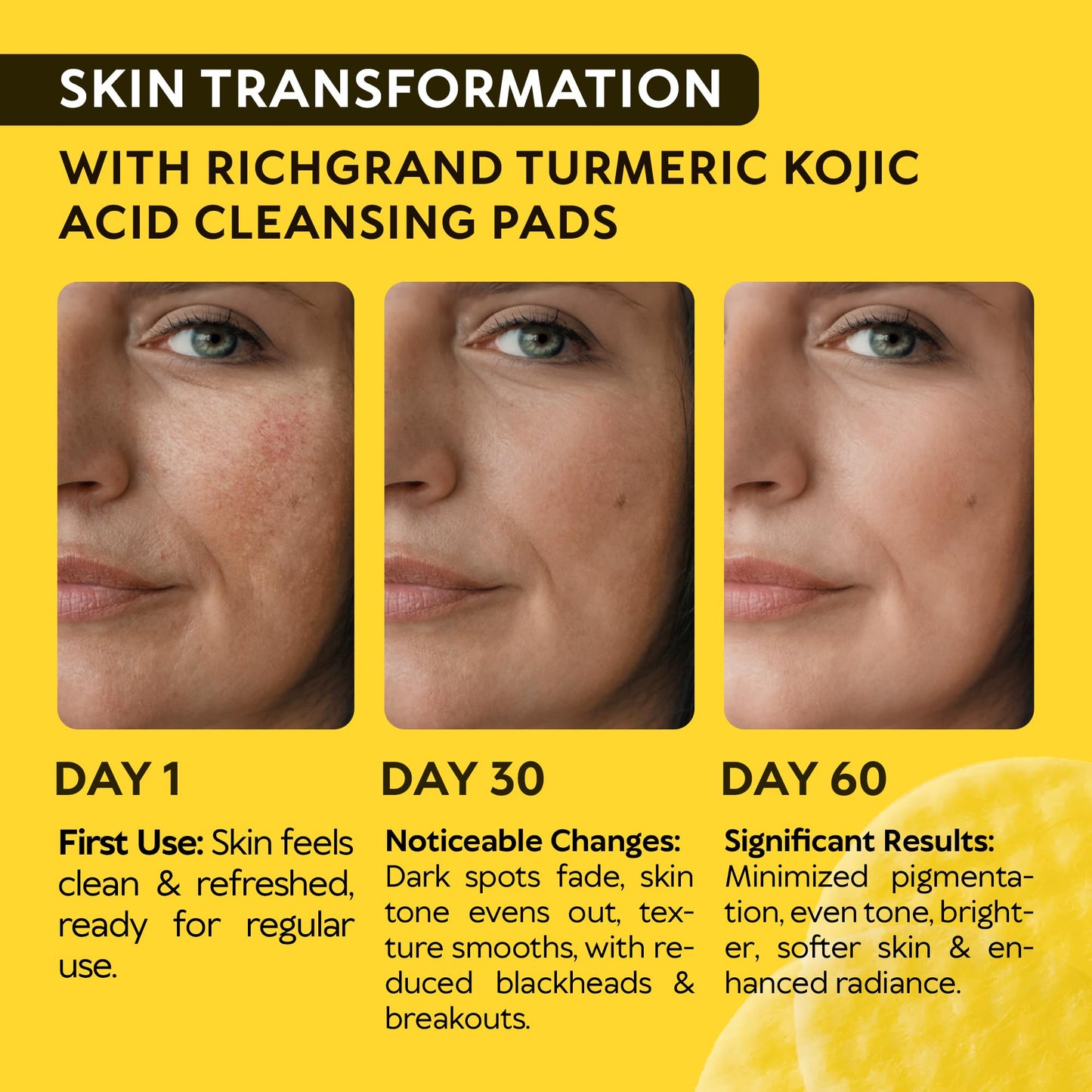 RichGrand Turmeric Kojic Cleansing Pads – Foaming Face Wash with Vitamin C & Lemon