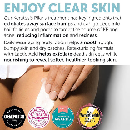 Rida Keratosis Pilaris Treatment – 10% AHA KP Lotion for Smooth, Hydrated Skin