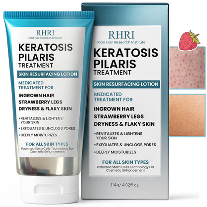 Rida Keratosis Pilaris Treatment – 10% AHA KP Lotion for Smooth, Hydrated Skin