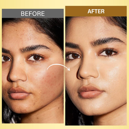 RIHAKO Turmeric Rosehip Face Oil for Gua Sha – Hydrating Anti-Aging Glow