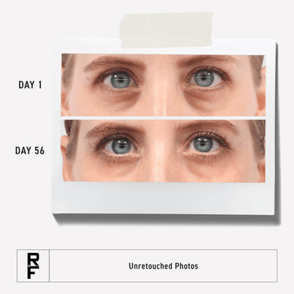 RODAN + FIELDS Active Hydration Bright Eye Complex | 15ml | Hydrating Eye Cream
