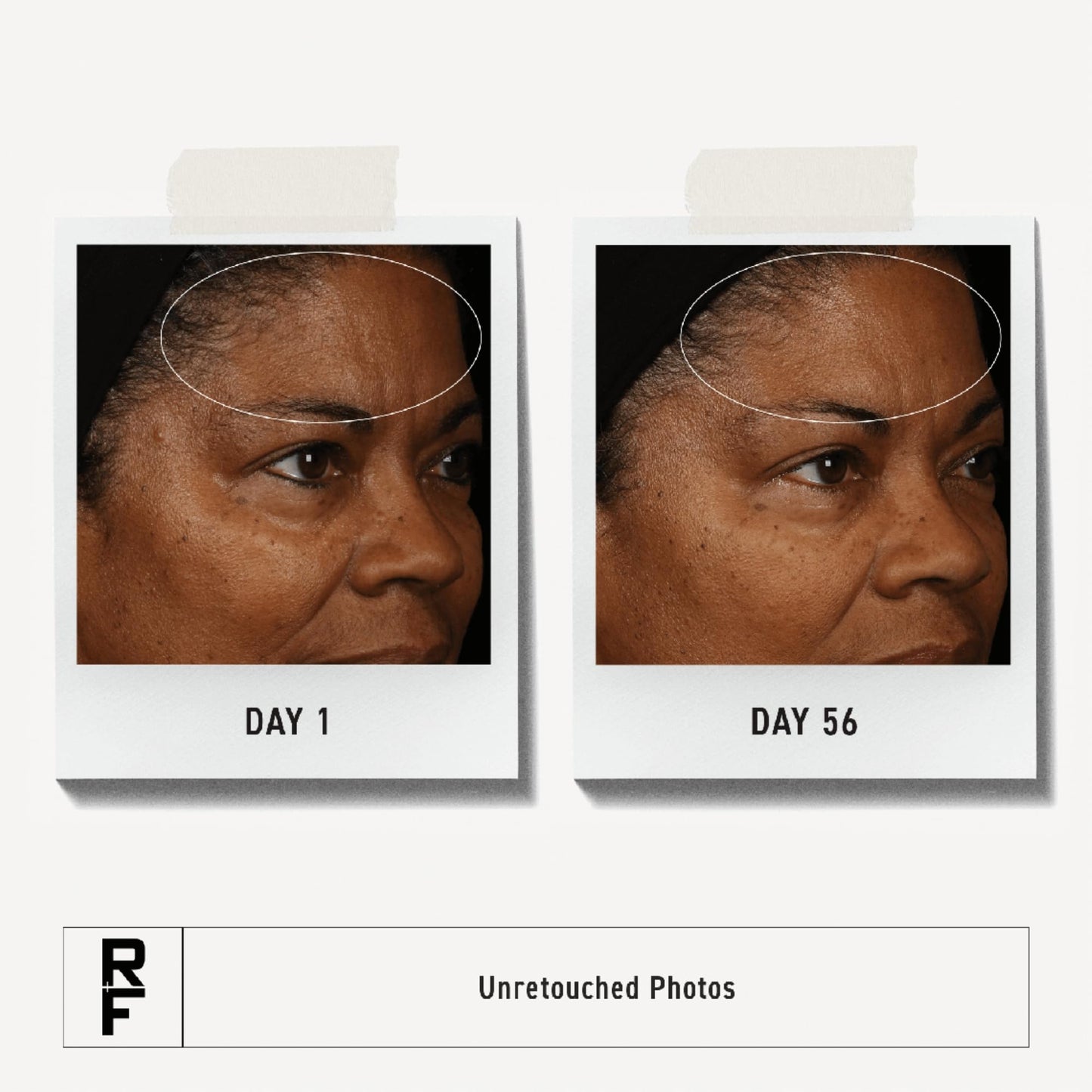 RODAN + FIELDS Redefine Overnight Restorative Cream – Step 3 PM Night Moisturizer with Glycolic Acid & Bakuchiol