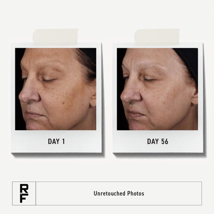 Rodan + Fields Reverse Deep Exfoliating Cleanser – 125 mL | Refine Texture with Glycolic + AHAs